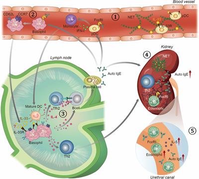 T Helper 2-Associated Immunity in the Pathogenesis of Systemic Lupus Erythematosus